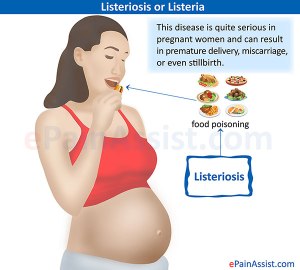 Listeriosis-or-Listeria-final
